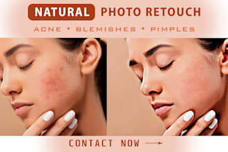 do natural photo retouching, remove acne, pimples, blemishes professionally