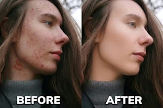 expertly retouch portraits to remove acne and enhance beauty