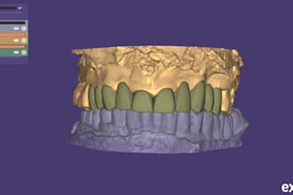do precise dental cad cam designing for crowns and partial dentures