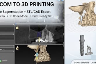 develop medical imaging cad software for dicom bone segmentation and 3d printing
