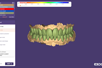 design precise exocad dental crowns, bridges and veneers