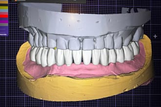 design precise 3d dental restorations using exocad