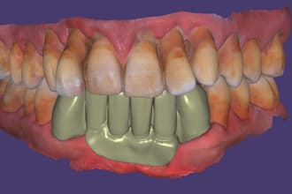 do expert dental design on exocad crowns, bridges and more