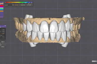 design full arch dental restoration crownsbr idges and veneers using exocad