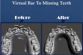 do high quality dental 3d file meshing with meshmixer