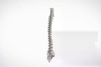 create 3d medical animation, ,medical device animation, surgical visualization