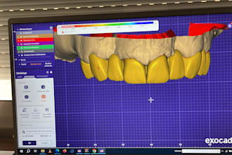 create professional dental cad designs with exocad