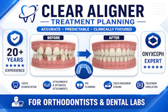 professional clear aligner treatment planning