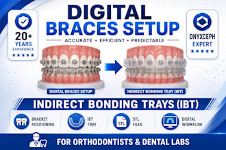 design digital braces setup and indirect bonding trays