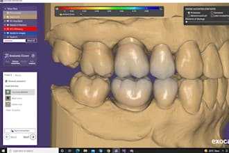 design dental crowns from stl scans using cad software