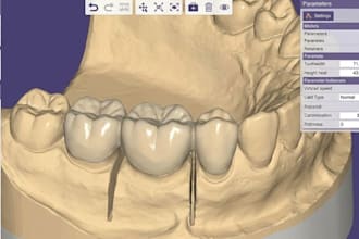 design dental bridge cad from stl scans for manufacturing