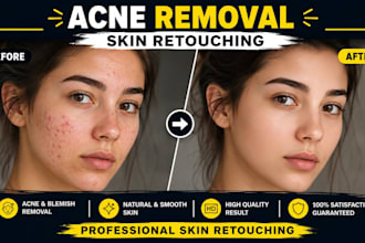 remove pimples, acne, scars and skin blemishes