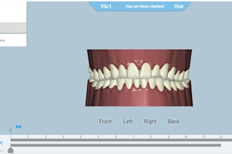 do clear aligner treatment planning setup and stepping