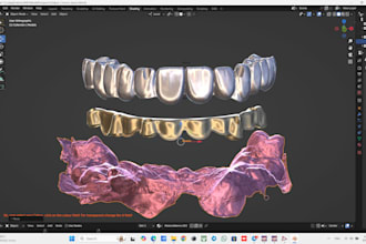 design professional dental cad cases exocad surgical guides and aligners
