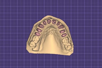 design dental crowns and bridge in exocad