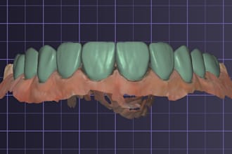 do crown and veneer design