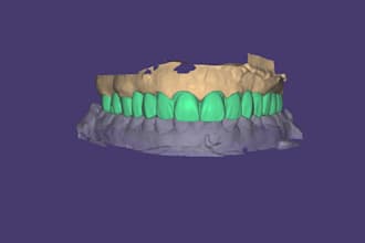 design custom crowns, bridges using exocad
