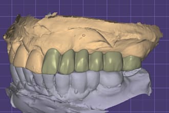 do exocad dental cad design for crowns, bridges and more