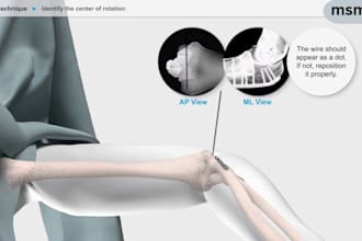 3d medical device animation and surgical product visualization