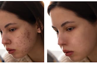 do professional skin retouching, pimple and acne removal