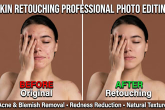 do high and skin retouching acne removal and beauty retouch