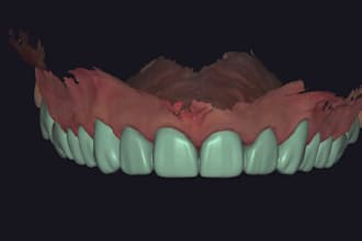 design dental design with exocad software for you