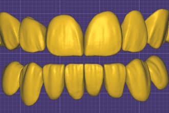 create professional 3d dental cad designs using exocad
