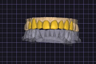 design custom exocad anterior smile makeovers and full arch restorations