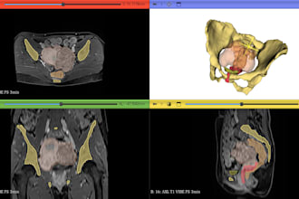 segment medical data and create accurate medical 3d models