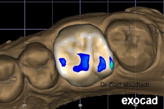 design smiles in exocad software for competing prices