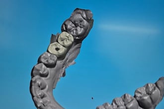 do expert dental design on 3shape crowns, bridges and more