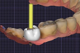 design dental cad restorations using exocad