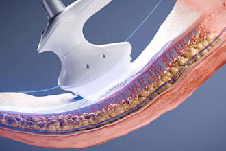 create realistic 3d medical animation, surgery animation, 3d medical video
