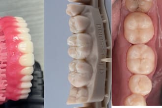 design dental cad models using exocad for crowns, bridges, veneers and dentures