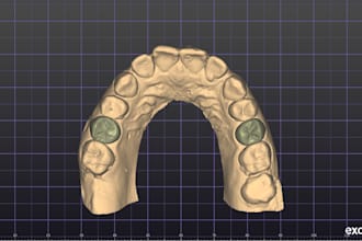create professional dental cad designs in exocad