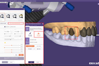 design dental crowns bridges implants restoration in exocad stl file 3d printing