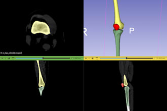 do 3d medical image segmentation from ct using 3d slicer