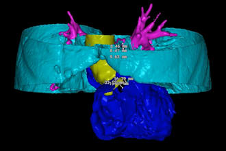 segment 3d models of the heart