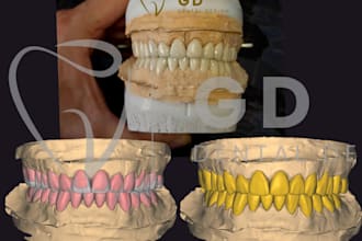 design precise dental cad in exocad for crowns and bridges