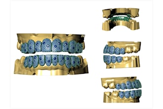 design custom grillz cad for 3d printing
