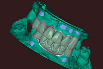 do professional dental cad cam design using exocad