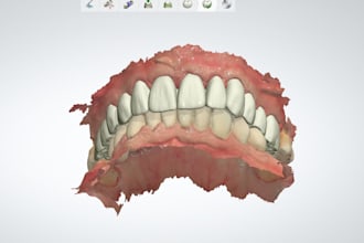 design anatomical crown and bridges using 3shape dental system