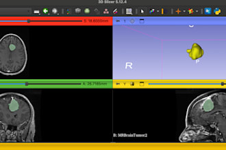 create 3d anatomical models from ct or mri dicom images