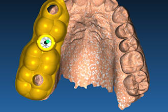 design precise 3d dental surgical guides and implant planning