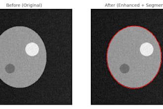 matlab biomedical signal and image processing