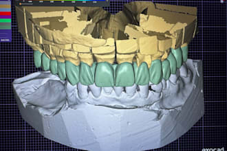 design full arch and multi unit dental bridges in exocad