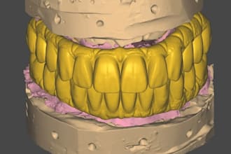 design full arch and multi unit dental bridges in exocad