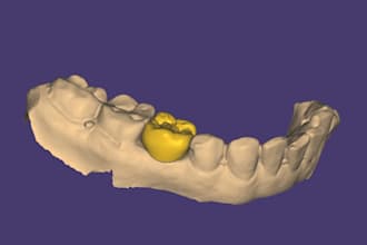 do expert dental design on exocad crowns, bridges and more
