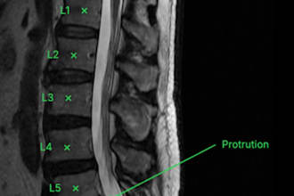 provide expert radiology and neuroradiology image review