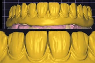 design dental crowns and bridges in exoca
